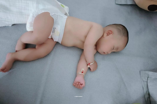 莱州六个月宝宝眼睛散光